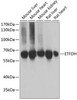 Western blot analysis of extracts of various cell lines, using ETFDH antibody (22-332) at 1:1000 dilution.<br/>Secondary antibody: HRP Goat Anti-Rabbit IgG (H+L) at 1:10000 dilution.<br/>Lysates/proteins: 25ug per lane.<br/>Blocking buffer: 3% nonfat dry milk in TBST.<br/>Detection: ECL Basic Kit.<br/>Exposure time: 3s.
