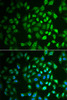 Immunofluorescence analysis of A549 cells using FAH antibody (22-333) . Blue: DAPI for nuclear staining.