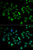Immunofluorescence analysis of MCF7 cells using FLOT2 antibody (22-336) . Blue: DAPI for nuclear staining.