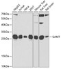 Western blot analysis of extracts of various cell lines, using GAMT antibody (22-340) at 1:1000 dilution.<br/>Secondary antibody: HRP Goat Anti-Rabbit IgG (H+L) at 1:10000 dilution.<br/>Lysates/proteins: 25ug per lane.<br/>Blocking buffer: 3% nonfat dry milk in TBST.<br/>Detection: ECL Basic Kit.<br/>Exposure time: 90s.