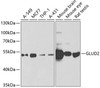 Western blot analysis of extracts of various cell lines, using GLUD2 antibody (22-344) at 1:1000 dilution.<br/>Secondary antibody: HRP Goat Anti-Rabbit IgG (H+L) at 1:10000 dilution.<br/>Lysates/proteins: 25ug per lane.<br/>Blocking buffer: 3% nonfat dry milk in TBST.<br/>Detection: ECL Basic Kit.<br/>Exposure time: 90s.