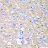 Immunohistochemistry of paraffin-embedded mouse heart using GPAM antibody (22-348) at dilution of 1:100 (40x lens) .