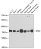 Western blot analysis of extracts of various cell lines, using GPD2 antibody (22-349) at 1:1000 dilution.<br/>Secondary antibody: HRP Goat Anti-Rabbit IgG (H+L) at 1:10000 dilution.<br/>Lysates/proteins: 25ug per lane.<br/>Blocking buffer: 3% nonfat dry milk in TBST.<br/>Detection: ECL Basic Kit.<br/>Exposure time: 10s.