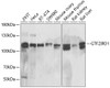 Western blot analysis of extracts of various cell lines, using GTF2IRD1 antibody (22-351) at 1:1000 dilution.<br/>Secondary antibody: HRP Goat Anti-Rabbit IgG (H+L) at 1:10000 dilution.<br/>Lysates/proteins: 25ug per lane.<br/>Blocking buffer: 3% nonfat dry milk in TBST.<br/>Detection: ECL Enhanced Kit.<br/>Exposure time: 5min.