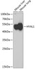 Western blot analysis of extracts of various cell lines, using HYAL1 Antibody (22-360) at 1:1000 dilution.<br/>Secondary antibody: HRP Goat Anti-Rabbit IgG (H+L) at 1:10000 dilution.<br/>Lysates/proteins: 25ug per lane.<br/>Blocking buffer: 3% nonfat dry milk in TBST.<br/>Detection: ECL Basic Kit.<br/>Exposure time: 90s.