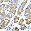 Immunohistochemistry of paraffin-embedded human stomach using HYAL1 antibody (22-360) at dilution of 1:100 (40x lens) .