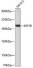 Western blot analysis of extracts of SKOV3 cells, using KIF1B antibody (22-371) at 1:1000 dilution.<br/>Secondary antibody: HRP Goat Anti-Rabbit IgG (H+L) at 1:10000 dilution.<br/>Lysates/proteins: 25ug per lane.<br/>Blocking buffer: 3% nonfat dry milk in TBST.<br/>Detection: ECL Basic Kit.<br/>Exposure time: 90s.