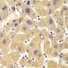 Immunohistochemistry of paraffin-embedded human liver damage using KIF1B Antibody (22-371) at dilution of 1:100 (40x lens) .