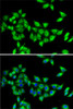 Immunofluorescence analysis of MCF7 cells using KIF3A antibody (22-372) . Blue: DAPI for nuclear staining.