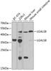 Western blot analysis of extracts of various cell lines, using LGALS8 antibody (22-376) at 1:1000 dilution.<br/>Secondary antibody: HRP Goat Anti-Rabbit IgG (H+L) at 1:10000 dilution.<br/>Lysates/proteins: 25ug per lane.<br/>Blocking buffer: 3% nonfat dry milk in TBST.<br/>Detection: ECL Basic Kit.<br/>Exposure time: 90s.