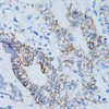 Immunohistochemistry of paraffin-embedded human colon carcinoma using LGALS8 antibody (22-376) at dilution of 1:100 (40x lens) .