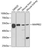 Western blot analysis of extracts of various cell lines, using MAPRE2 antibody (22-378) at 1:1000 dilution.<br/>Secondary antibody: HRP Goat Anti-Rabbit IgG (H+L) at 1:10000 dilution.<br/>Lysates/proteins: 25ug per lane.<br/>Blocking buffer: 3% nonfat dry milk in TBST.<br/>Detection: ECL Basic Kit.<br/>Exposure time: 90s.