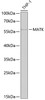 Western blot analysis of extracts of THP-1 cells, using MATK antibody (22-380) at 1:1000 dilution.<br/>Secondary antibody: HRP Goat Anti-Rabbit IgG (H+L) at 1:10000 dilution.<br/>Lysates/proteins: 25ug per lane.<br/>Blocking buffer: 3% nonfat dry milk in TBST.<br/>Detection: ECL Basic Kit.<br/>Exposure time: 90s.