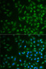 Immunofluorescence analysis of MCF7 cells using MPP2 antibody (22-385) . Blue: DAPI for nuclear staining.