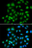 Immunofluorescence analysis of HeLa cells using MXI1 antibody (22-387) . Blue: DAPI for nuclear staining.