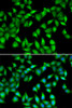 Immunofluorescence analysis of U2OS cells using MYL3 antibody (22-388) . Blue: DAPI for nuclear staining.