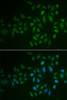 Immunofluorescence analysis of U2OS cells using MYLK3 antibody (22-389) . Blue: DAPI for nuclear staining.