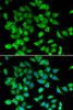 Immunofluorescence analysis of HeLa cells using NFATC3 antibody (22-392) . Blue: DAPI for nuclear staining.