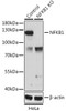 Western blot analysis of extracts from normal (control) and NFKB1 knockout (KO) HeLa cells, using NFKB1 antibody (22-393) at 1:1000 dilution.<br/>Secondary antibody: HRP Goat Anti-Rabbit IgG (H+L) at 1:10000 dilution.<br/>Lysates/proteins: 25ug per lane.<br/>Blocking buffer: 3% nonfat dry milk in TBST.<br/>Detection: ECL Basic Kit.<br/>Exposure time: 30s.