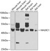 Western blot analysis of extracts of various cell lines, using NHLRC1 antibody (22-395) at 1:1000 dilution.<br/>Secondary antibody: HRP Goat Anti-Rabbit IgG (H+L) at 1:10000 dilution.<br/>Lysates/proteins: 25ug per lane.<br/>Blocking buffer: 3% nonfat dry milk in TBST.<br/>Detection: ECL Basic Kit.<br/>Exposure time: 30s.