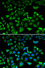 Immunofluorescence analysis of HeLa cells using NHLRC1 antibody (22-395) . Blue: DAPI for nuclear staining.