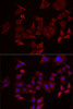 Immunofluorescence analysis of MCF7 cells using NPHP1 antibody (22-397) . Blue: DAPI for nuclear staining.