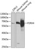 Western blot analysis of extracts of various cell lines, using P2RX4 antibody (22-402) at 1:1000 dilution.<br/>Secondary antibody: HRP Goat Anti-Rabbit IgG (H+L) at 1:10000 dilution.<br/>Lysates/proteins: 25ug per lane.<br/>Blocking buffer: 3% nonfat dry milk in TBST.<br/>Detection: ECL Basic Kit.<br/>Exposure time: 30s.