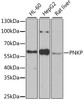 Western blot analysis of extracts of various cell lines, using PNKP antibody (22-410) at 1:1000 dilution.<br/>Secondary antibody: HRP Goat Anti-Rabbit IgG (H+L) at 1:10000 dilution.<br/>Lysates/proteins: 25ug per lane.<br/>Blocking buffer: 3% nonfat dry milk in TBST.<br/>Detection: ECL Basic Kit.<br/>Exposure time: 90s.