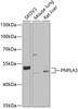 Western blot analysis of extracts of various cell lines, using PNPLA3 Antibody (22-411) at 1:1000 dilution.<br/>Secondary antibody: HRP Goat Anti-Rabbit IgG (H+L) at 1:10000 dilution.<br/>Lysates/proteins: 25ug per lane.<br/>Blocking buffer: 3% nonfat dry milk in TBST.<br/>Detection: ECL Basic Kit.<br/>Exposure time: 30s.