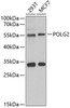 Western blot analysis of extracts of various cell lines, using POLG2 antibody (22-412) at 1:1000 dilution.<br/>Secondary antibody: HRP Goat Anti-Rabbit IgG (H+L) at 1:10000 dilution.<br/>Lysates/proteins: 25ug per lane.<br/>Blocking buffer: 3% nonfat dry milk in TBST.<br/>Detection: ECL Basic Kit.<br/>Exposure time: 90s.