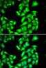 Immunofluorescence analysis of HeLa cells using PPM1A antibody (22-416) . Blue: DAPI for nuclear staining.