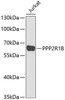 Western blot analysis of extracts of Jurkat cells, using PPP2R1B antibody (22-420) at 1:1000 dilution.<br/>Secondary antibody: HRP Goat Anti-Rabbit IgG (H+L) at 1:10000 dilution.<br/>Lysates/proteins: 25ug per lane.<br/>Blocking buffer: 3% nonfat dry milk in TBST.<br/>Detection: ECL Basic Kit.<br/>Exposure time: 90s.