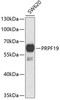 Western blot analysis of extracts of SW620 cells, using PRPF19 antibody (22-422) at 1:1000 dilution.<br/>Secondary antibody: HRP Goat Anti-Rabbit IgG (H+L) at 1:10000 dilution.<br/>Lysates/proteins: 25ug per lane.<br/>Blocking buffer: 3% nonfat dry milk in TBST.<br/>Detection: ECL Basic Kit.<br/>Exposure time: 90s.