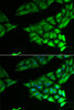 Immunofluorescence analysis of U2OS cells using PSAT1 antibody (22-423) . Blue: DAPI for nuclear staining.