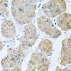 Immunohistochemistry of paraffin-embedded human stomach using RAPSN antibody (22-432) at dilution of 1:100 (40x lens) .