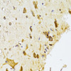 Immunohistochemistry of paraffin-embedded rat spinal cord using RPL13 Antibody (22-437) at dilution of 1:100 (40x lens) .