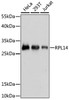 Immunohistochemistry of paraffin-embedded rat liver using RPL14 antibody (22-438) at dilution of 1:100 (40x lens) .