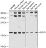 Western blot analysis of extracts of various cell lines, using RPLP1 antibody (22-439) at 1:1000 dilution.<br/>Secondary antibody: HRP Goat Anti-Rabbit IgG (H+L) at 1:10000 dilution.<br/>Lysates/proteins: 25ug per lane.<br/>Blocking buffer: 3% nonfat dry milk in TBST.<br/>Detection: ECL Basic Kit.<br/>Exposure time: 60s.