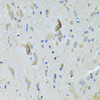 Immunohistochemistry of paraffin-embedded rat spinal cord using SARS Antibody (22-446) at dilution of 1:100 (40x lens) .