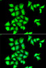 Immunofluorescence analysis of HeLa cells using MSRB1 antibody (22-449) . Blue: DAPI for nuclear staining.