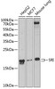Western blot analysis of extracts of various cell lines, using SRI Antibody (22-460) at 1:1000 dilution.<br/>Secondary antibody: HRP Goat Anti-Rabbit IgG (H+L) at 1:10000 dilution.<br/>Lysates/proteins: 25ug per lane.<br/>Blocking buffer: 3% nonfat dry milk in TBST.<br/>Detection: ECL Basic Kit.<br/>Exposure time: 90s.