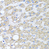 Immunohistochemistry of paraffin-embedded human liver damage using SRI antibody (22-460) at dilution of 1:100 (40x lens) .