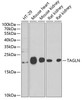 Western blot analysis of extracts of various cell lines, using TAGLN antibody (22-468) at 1:1000 dilution.<br/>Secondary antibody: HRP Goat Anti-Rabbit IgG (H+L) at 1:10000 dilution.<br/>Lysates/proteins: 25ug per lane.<br/>Blocking buffer: 3% nonfat dry milk in TBST.<br/>Detection: ECL Basic Kit.<br/>Exposure time: 90s.