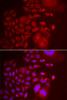 Immunofluorescence analysis of U2OS cells using TRAPPC10 antibody (22-478) . Blue: DAPI for nuclear staining.