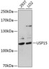 Western blot analysis of extracts of various cell lines, using USP15 antibody (22-486) at 1:1000 dilution.<br/>Secondary antibody: HRP Goat Anti-Rabbit IgG (H+L) at 1:10000 dilution.<br/>Lysates/proteins: 25ug per lane.<br/>Blocking buffer: 3% nonfat dry milk in TBST.<br/>Detection: ECL Basic Kit.<br/>Exposure time: 90s.