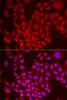 Immunofluorescence analysis of MCF7 cells using DCAF7 antibody (22-487) . Blue: DAPI for nuclear staining.