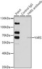 Immunoprecipitation analysis of 200ug extracts of HeLa cells using 1ug YARS antibody (22-489) . Western blot was performed from the immunoprecipitate using YARS antibody (22-489) at a dilition of 1:1000.