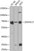 Western blot analysis of extracts of various cell lines, using ZDHHC17 antibody (22-490) at 1:1000 dilution.<br/>Secondary antibody: HRP Goat Anti-Rabbit IgG (H+L) at 1:10000 dilution.<br/>Lysates/proteins: 25ug per lane.<br/>Blocking buffer: 3% nonfat dry milk in TBST.<br/>Detection: ECL Basic Kit.<br/>Exposure time: 90s.