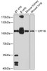 Western blot analysis of extracts of various cell lines, using CPT1B antibody (22-492) at 1:1000 dilution.<br/>Secondary antibody: HRP Goat Anti-Rabbit IgG (H+L) at 1:10000 dilution.<br/>Lysates/proteins: 25ug per lane.<br/>Blocking buffer: 3% nonfat dry milk in TBST.<br/>Detection: ECL Basic Kit.<br/>Exposure time: 60s.
