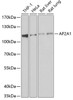 Western blot analysis of extracts of various cell lines, using AP2A1 antibody (22-512) at 1:1000 dilution.<br/>Secondary antibody: HRP Goat Anti-Rabbit IgG (H+L) at 1:10000 dilution.<br/>Lysates/proteins: 25ug per lane.<br/>Blocking buffer: 3% nonfat dry milk in TBST.<br/>Detection: ECL Basic Kit.<br/>Exposure time: 10s.